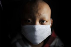 裝修除甲醛，預(yù)防白血病的其中一條途徑